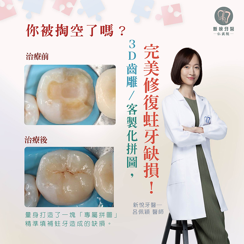 新悅美學牙醫診所的案例分享圖片